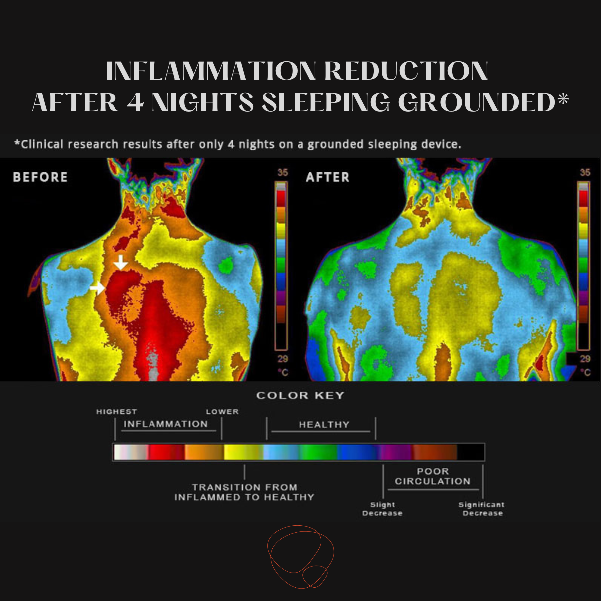 EarthPulse™ Grounding Bed Sheets